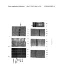 METHODS OF DIAGNOSING MUSCLE DAMAGE diagram and image