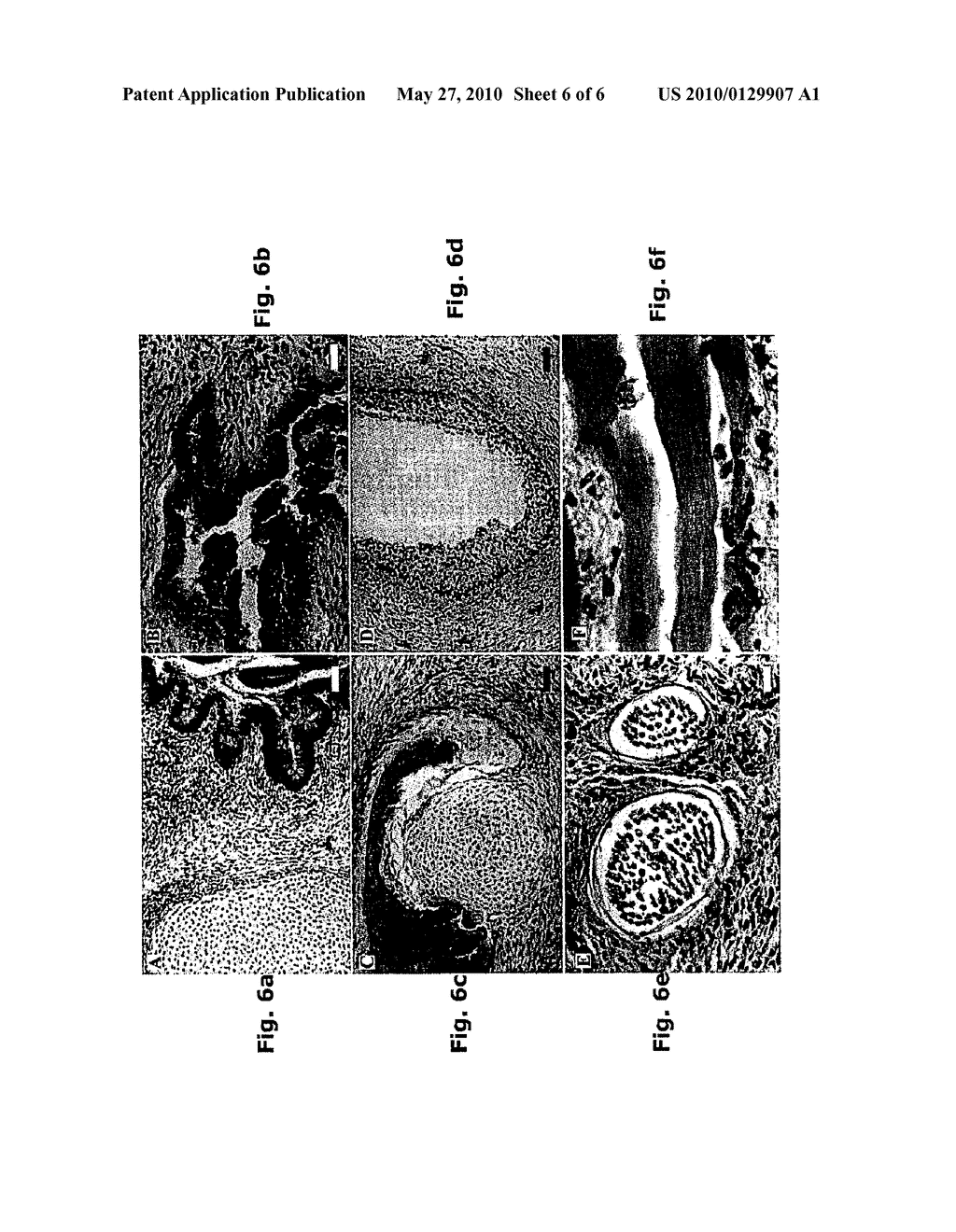 HUMAN FORESKIN FIBROBLAST CONDITIONED MEDIA FOR CULTURING ES CELLS - diagram, schematic, and image 07