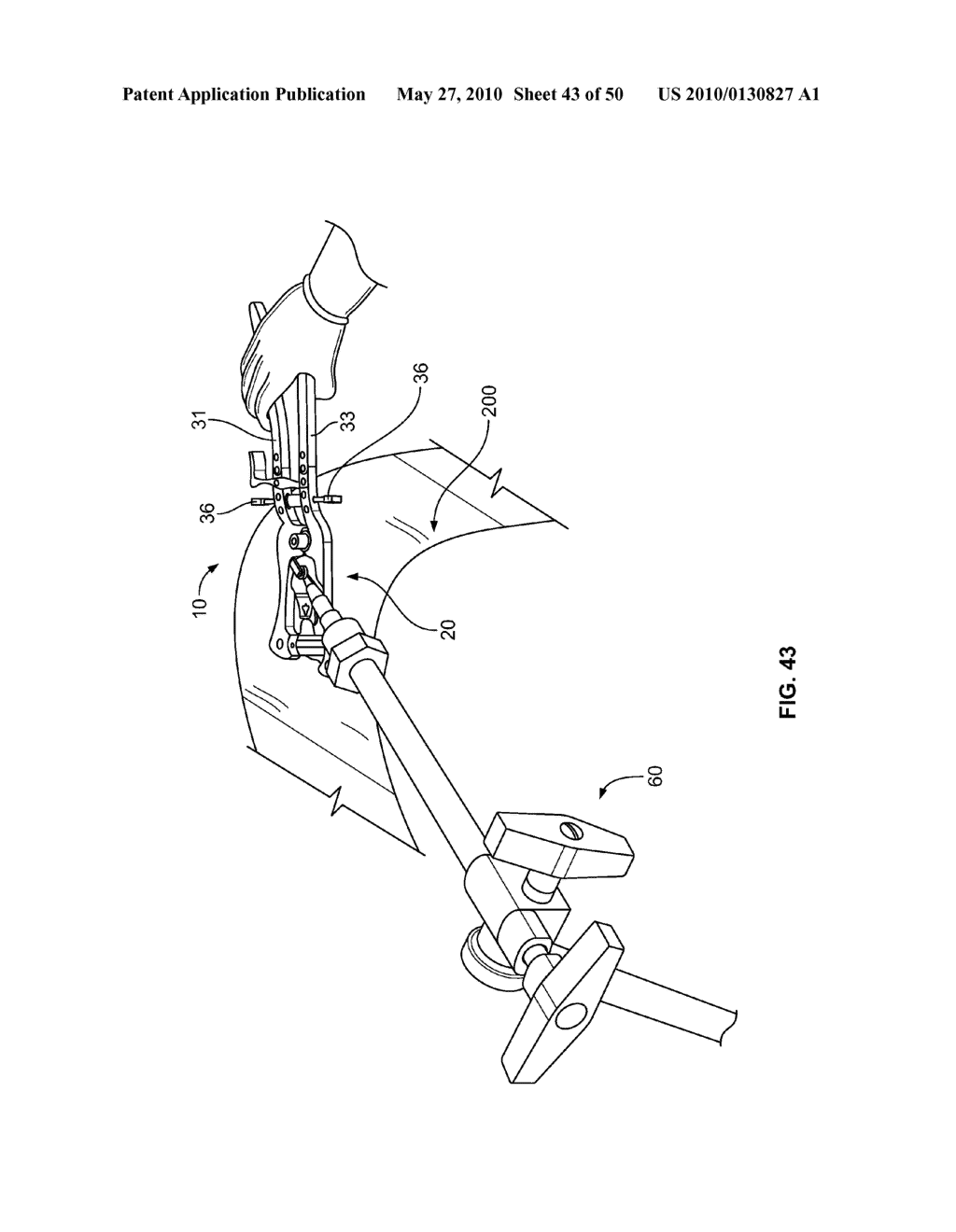 SURGICAL ACCESS SYSTEM AND RELATED METHODS - diagram, schematic, and image 44