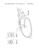 NAVIGATION ENABLED LEAD DELIVERY CATHETER diagram and image