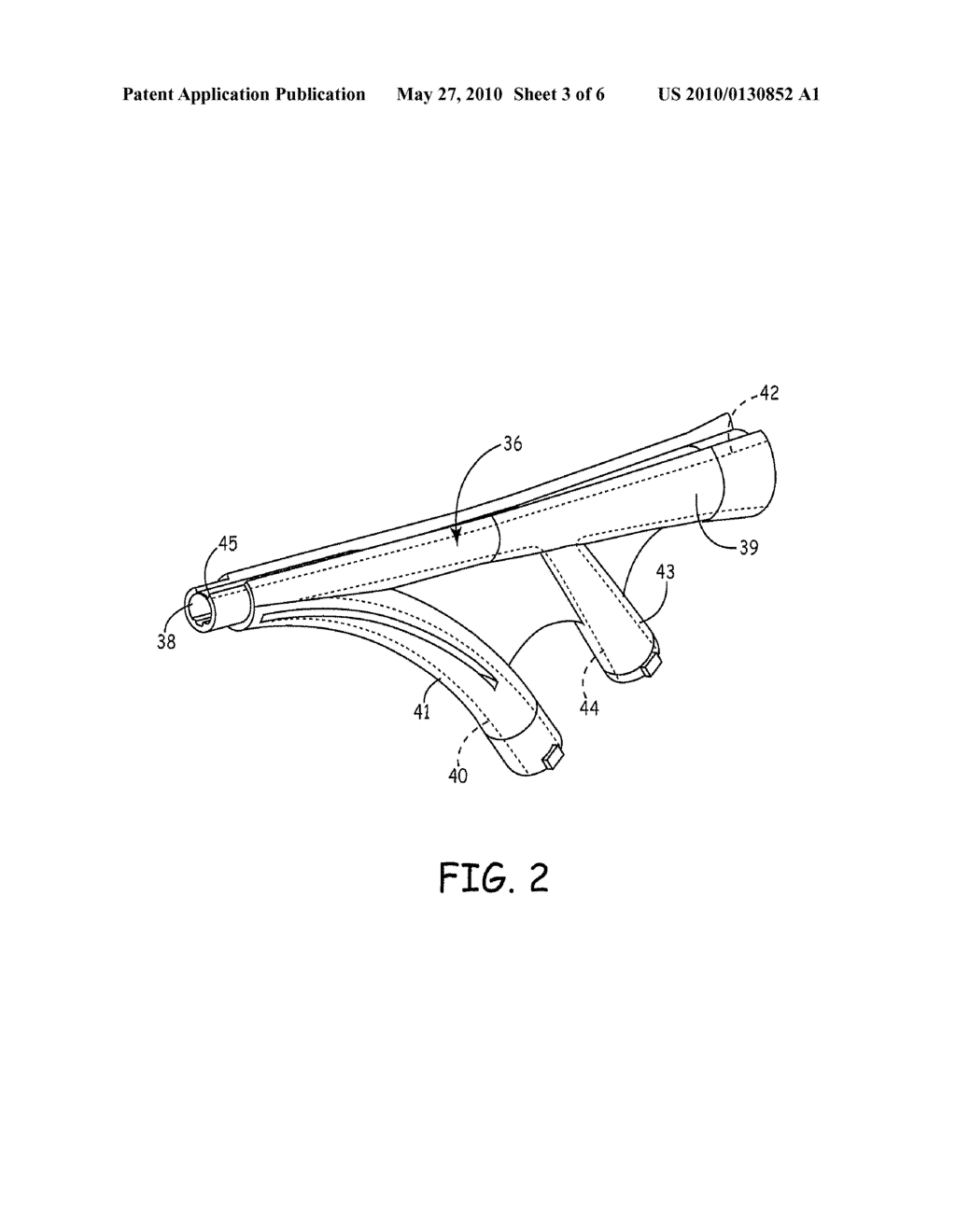 NAVIGATION ENABLED LEAD DELIVERY CATHETER - diagram, schematic, and image 04