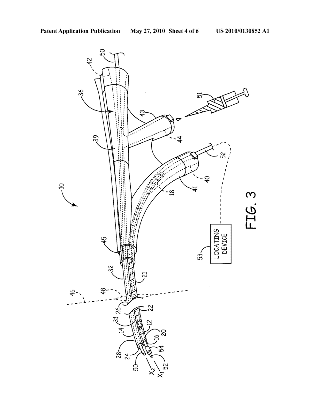 NAVIGATION ENABLED LEAD DELIVERY CATHETER - diagram, schematic, and image 05