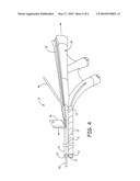 NAVIGATION ENABLED LEAD DELIVERY CATHETER diagram and image