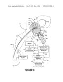 APPARATUS AND METHODS FOR MONITORING BLOOD FLOW IN THE PROSTRATE GLAND diagram and image