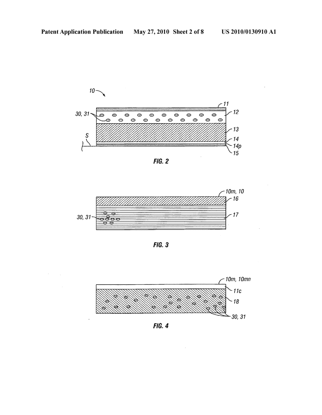 Patches and method for the transdermal delivery of a therapeutically effective amount of iron - diagram, schematic, and image 03