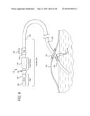 SYSTEMS AND METHODS FOR REMOVING AIR FROM SUPPLY CONTAINERS AND ASSOCIATED FILL TUBING diagram and image