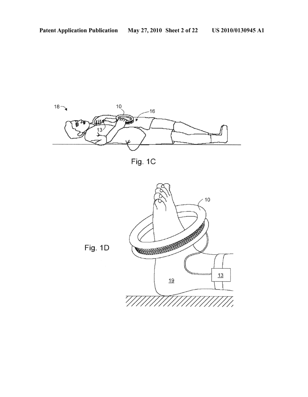 TREATMENT OF TISSUE VIA APPLICATION OF MAGNETIC FIELD - diagram, schematic, and image 03