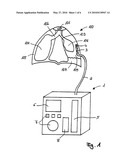 MOBILE CHEST DRAINAGE UNIT, THORACIC CATHETER, SYSTEM COMPRISING A MOBILE CHEST DRAINAGE UNIT AND A THORACIC CATHETER, AND MANUFACTURING METHOD THEREOF diagram and image