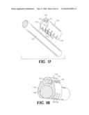 DEVICE AND METHOD FOR DELIVERY OF THERAPEUTIC AGENTS VIA ARTIFICIAL INTERNAL IMPLANTS diagram and image