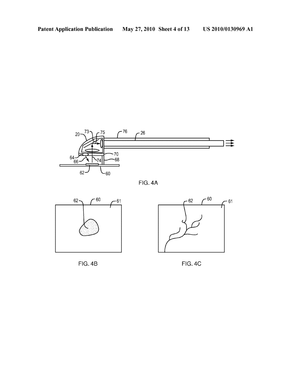 SYSTEM AND METHOD FOR DERMATOLOGICAL TREATMENT - diagram, schematic, and image 05