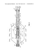 Cryogenic Ablation System and Method diagram and image