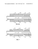 Cryogenic Ablation System and Method diagram and image