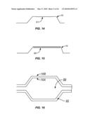 Cryogenic Ablation System and Method diagram and image