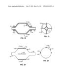 Cryogenic Ablation System and Method diagram and image