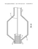 Cryogenic Ablation System and Method diagram and image