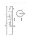 Cryogenic Ablation System and Method diagram and image