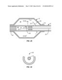 Cryogenic Ablation System and Method diagram and image