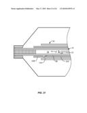 Cryogenic Ablation System and Method diagram and image