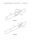 Cryogenic Ablation System and Method diagram and image