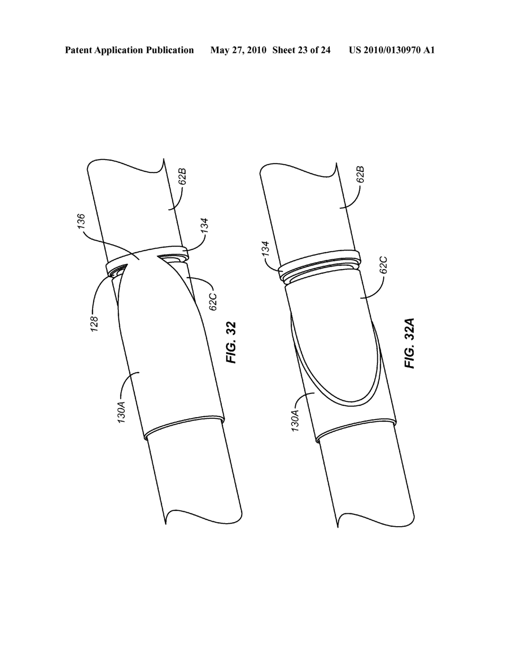 Cryogenic Ablation System and Method - diagram, schematic, and image 24