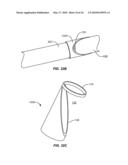 Cryogenic Ablation System and Method diagram and image