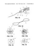 METHODS OF SUTURING AND REPAIRING TISSUE USING A CONTINUOUS SUTURE PASSER DEVICE diagram and image