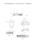 METHODS OF SUTURING AND REPAIRING TISSUE USING A CONTINUOUS SUTURE PASSER DEVICE diagram and image