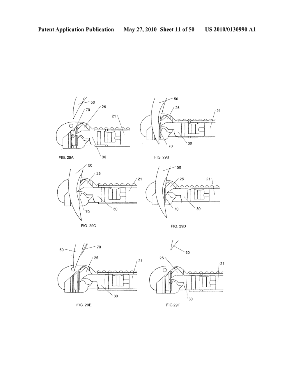 METHODS OF SUTURING AND REPAIRING TISSUE USING A CONTINUOUS SUTURE PASSER DEVICE - diagram, schematic, and image 12