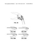 METHODS OF SUTURING AND REPAIRING TISSUE USING A CONTINUOUS SUTURE PASSER DEVICE diagram and image