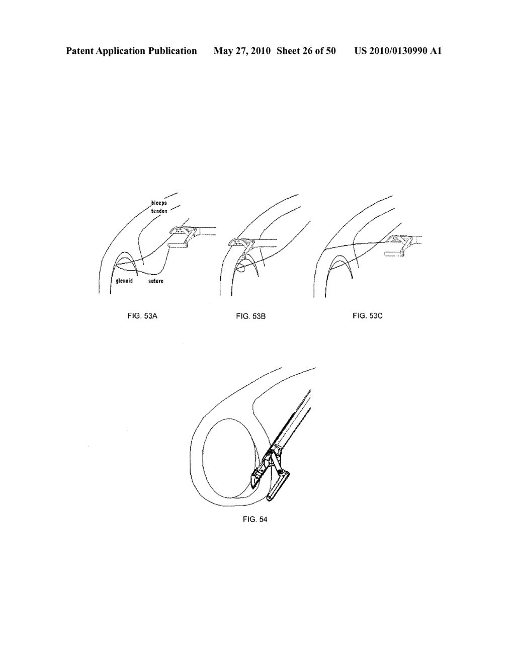 METHODS OF SUTURING AND REPAIRING TISSUE USING A CONTINUOUS SUTURE PASSER DEVICE - diagram, schematic, and image 27