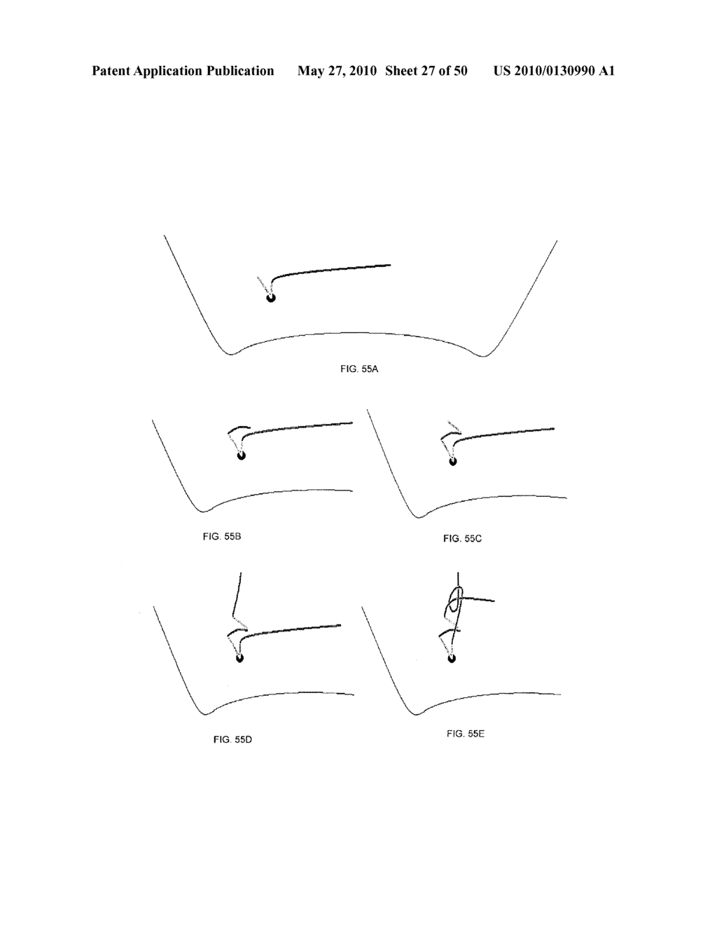 METHODS OF SUTURING AND REPAIRING TISSUE USING A CONTINUOUS SUTURE PASSER DEVICE - diagram, schematic, and image 28