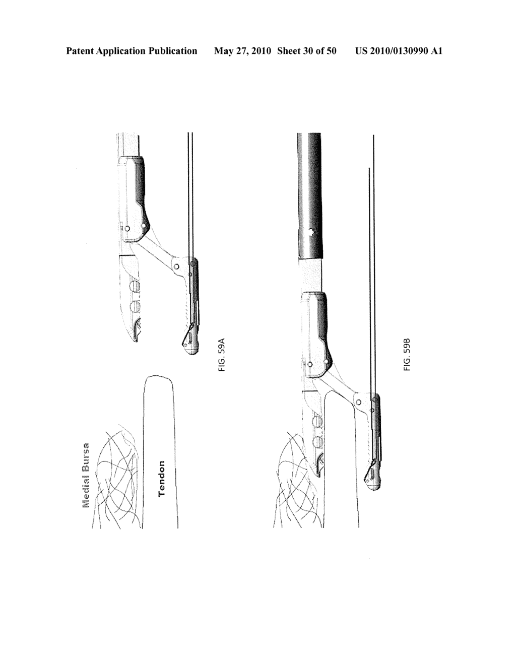 METHODS OF SUTURING AND REPAIRING TISSUE USING A CONTINUOUS SUTURE PASSER DEVICE - diagram, schematic, and image 31
