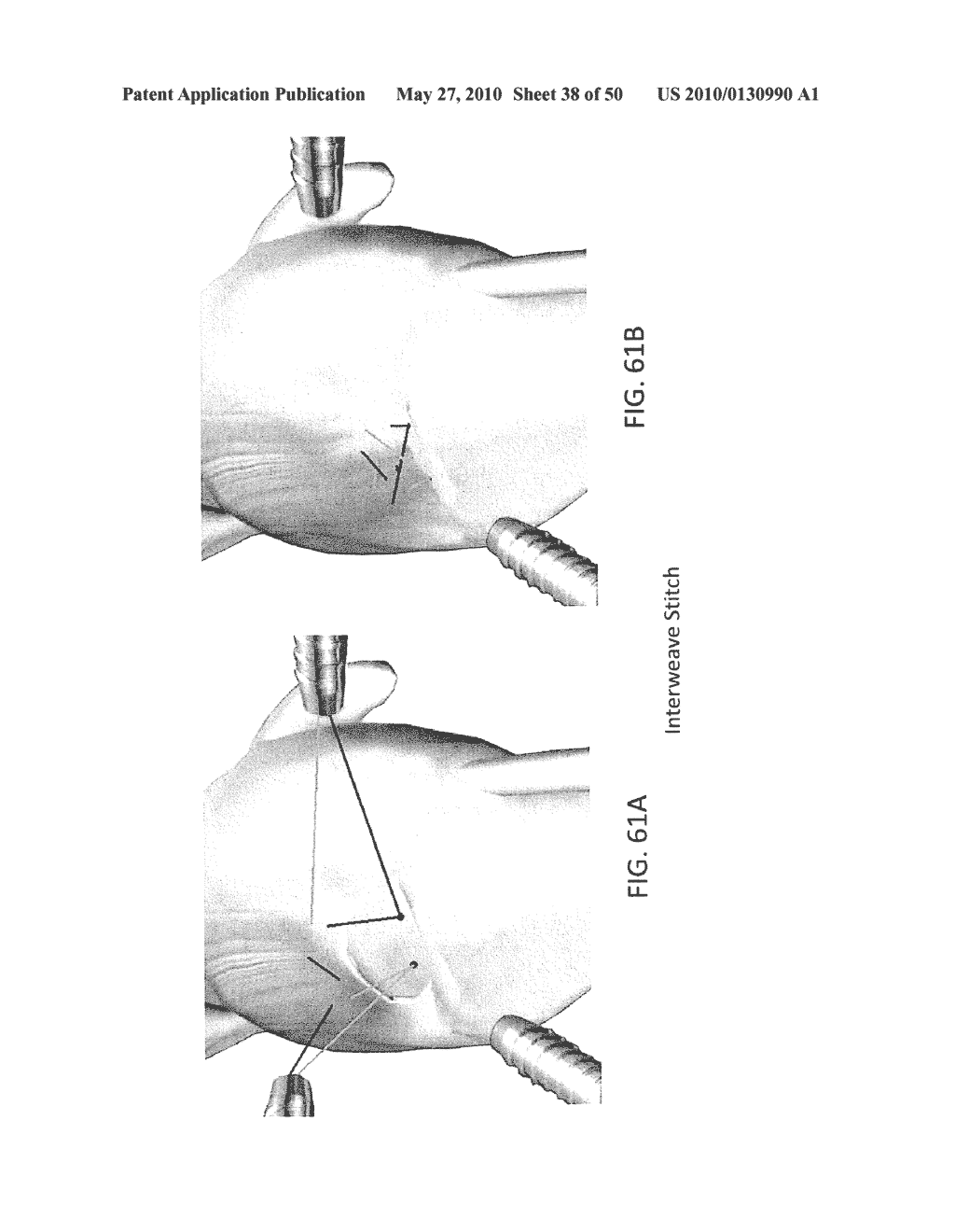 METHODS OF SUTURING AND REPAIRING TISSUE USING A CONTINUOUS SUTURE PASSER DEVICE - diagram, schematic, and image 39