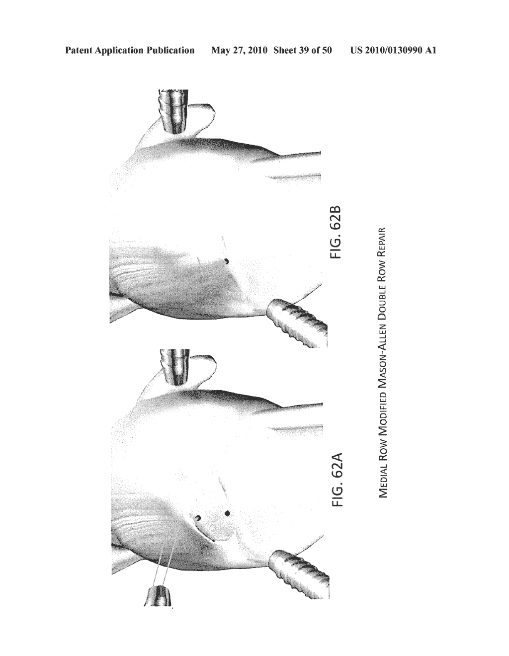 METHODS OF SUTURING AND REPAIRING TISSUE USING A CONTINUOUS SUTURE PASSER DEVICE - diagram, schematic, and image 40