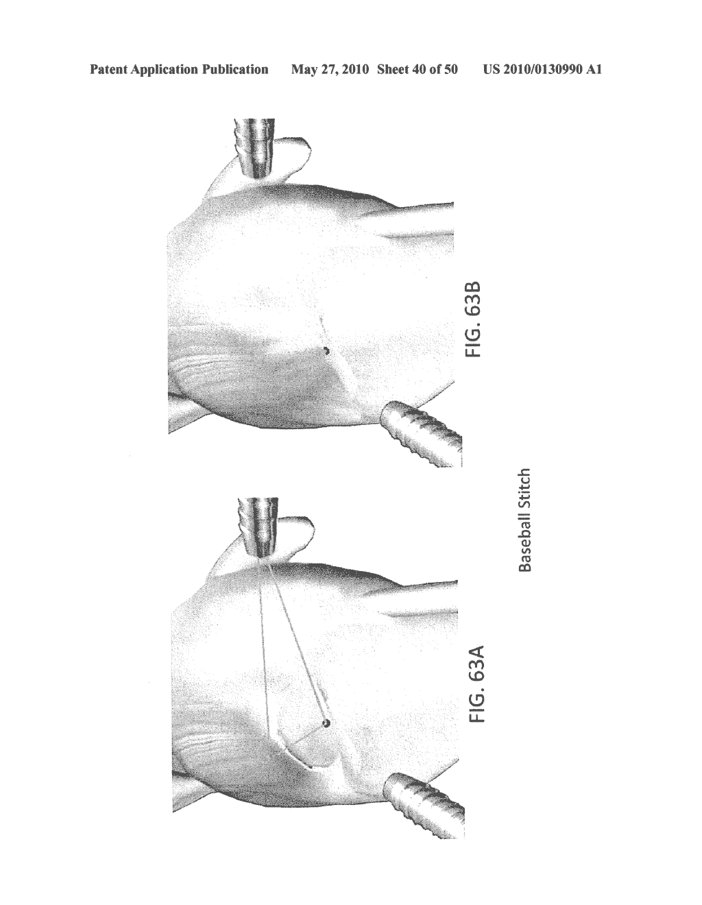 METHODS OF SUTURING AND REPAIRING TISSUE USING A CONTINUOUS SUTURE PASSER DEVICE - diagram, schematic, and image 41