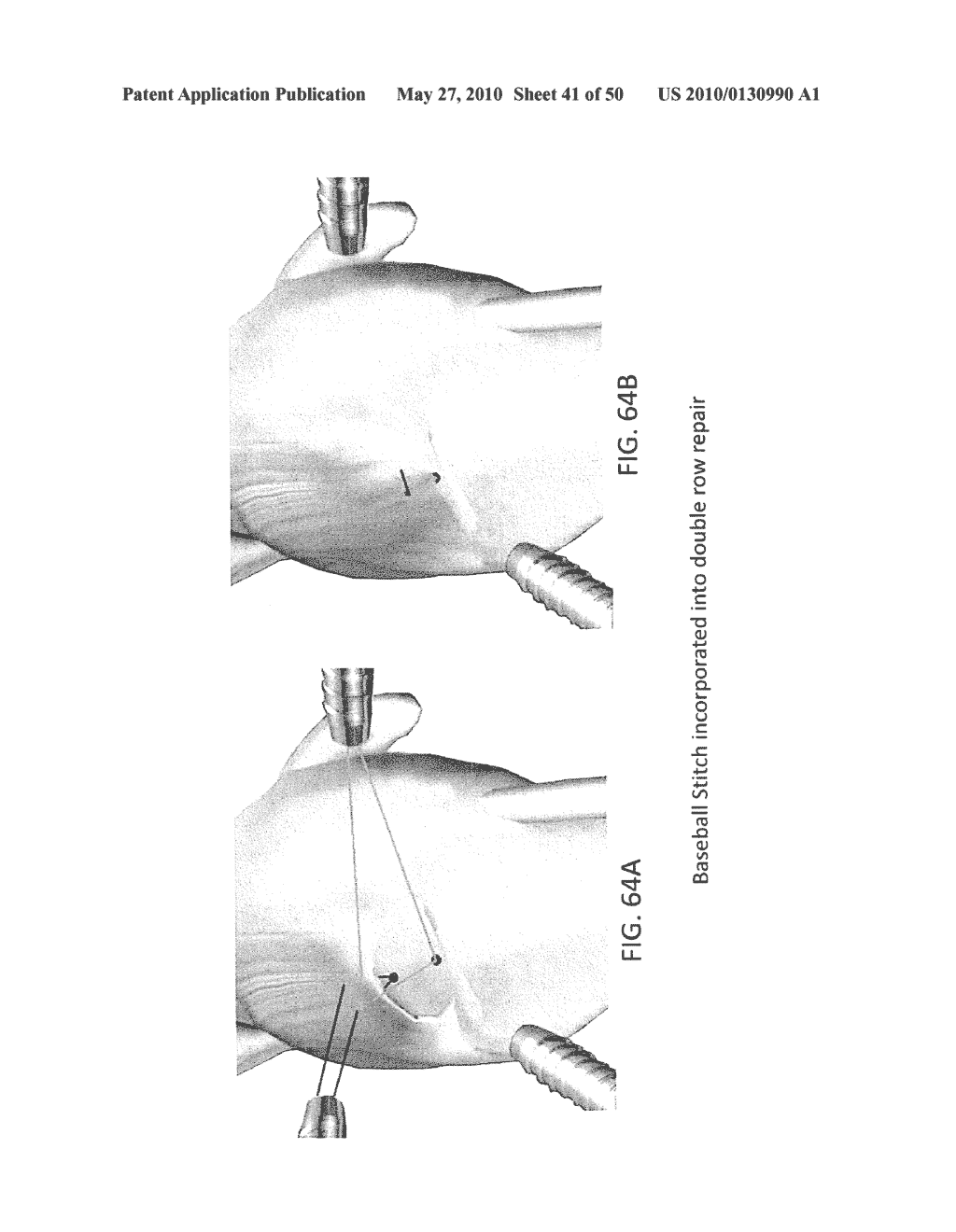 METHODS OF SUTURING AND REPAIRING TISSUE USING A CONTINUOUS SUTURE PASSER DEVICE - diagram, schematic, and image 42