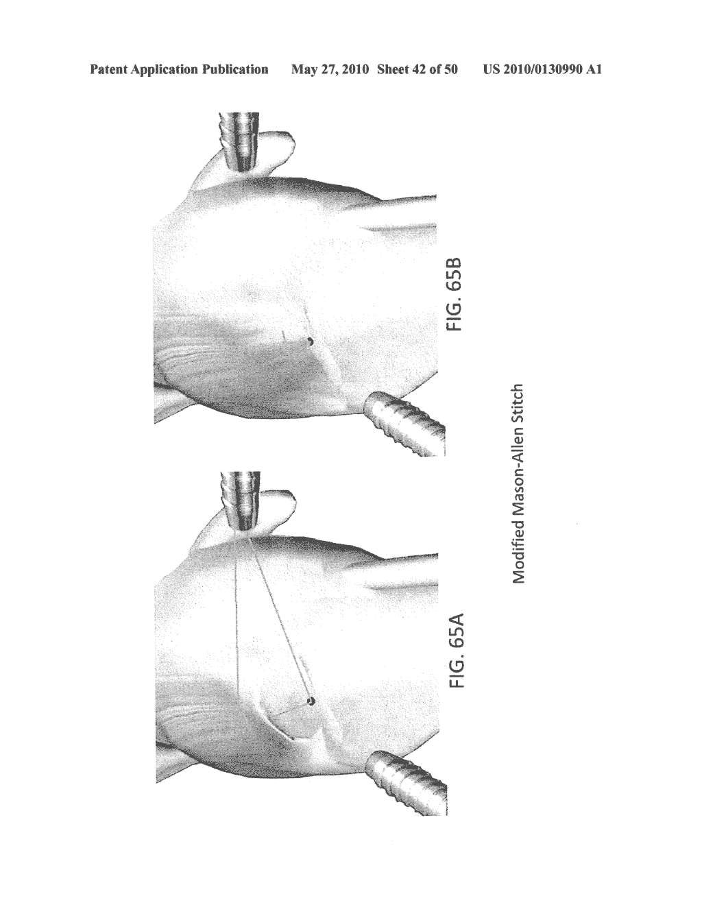 METHODS OF SUTURING AND REPAIRING TISSUE USING A CONTINUOUS SUTURE PASSER DEVICE - diagram, schematic, and image 43