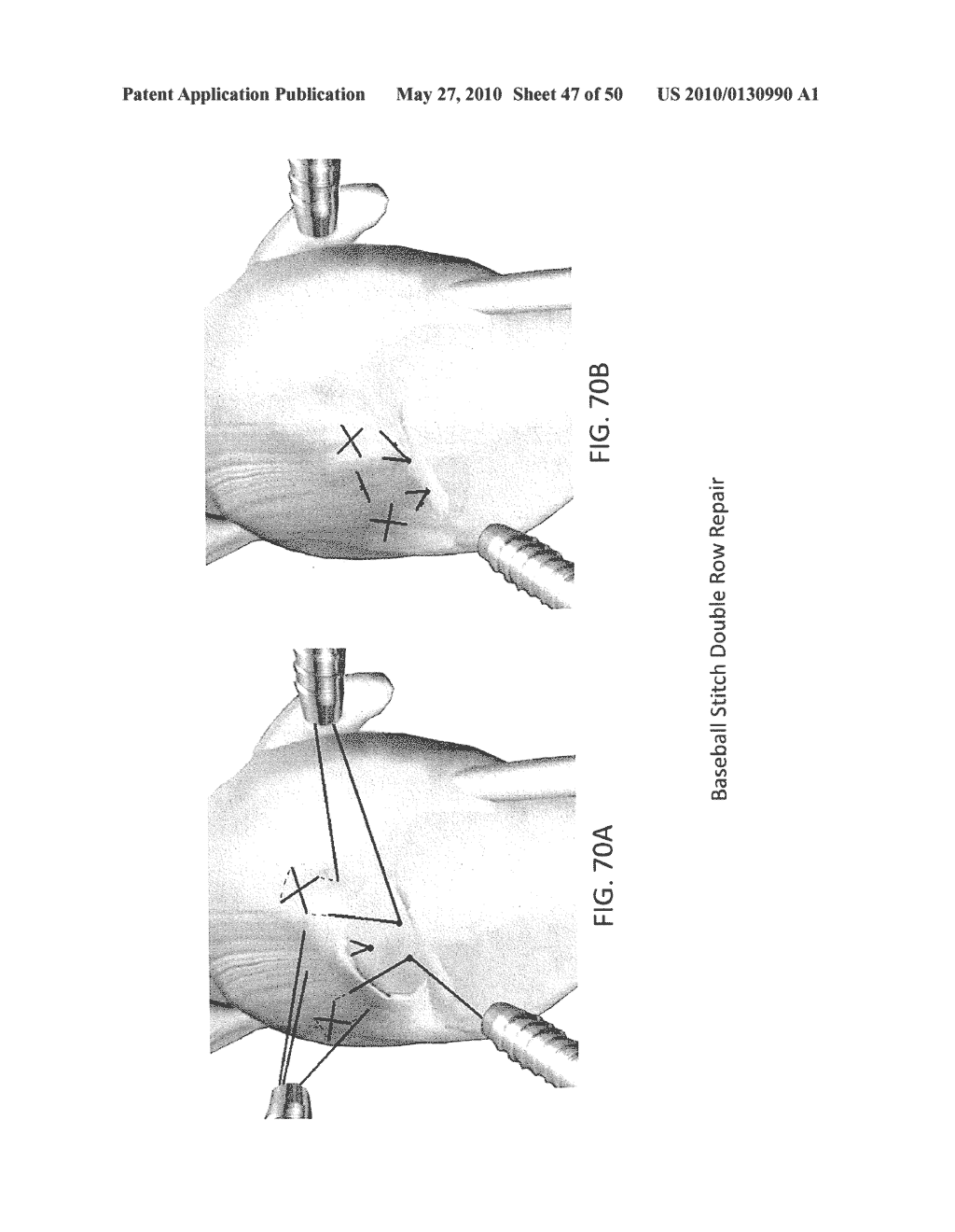 METHODS OF SUTURING AND REPAIRING TISSUE USING A CONTINUOUS SUTURE PASSER DEVICE - diagram, schematic, and image 48