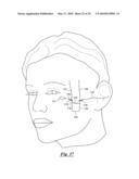 SURGICAL SUTURING DEVICE, METHOD AND TOOLS USED THEREWITH diagram and image