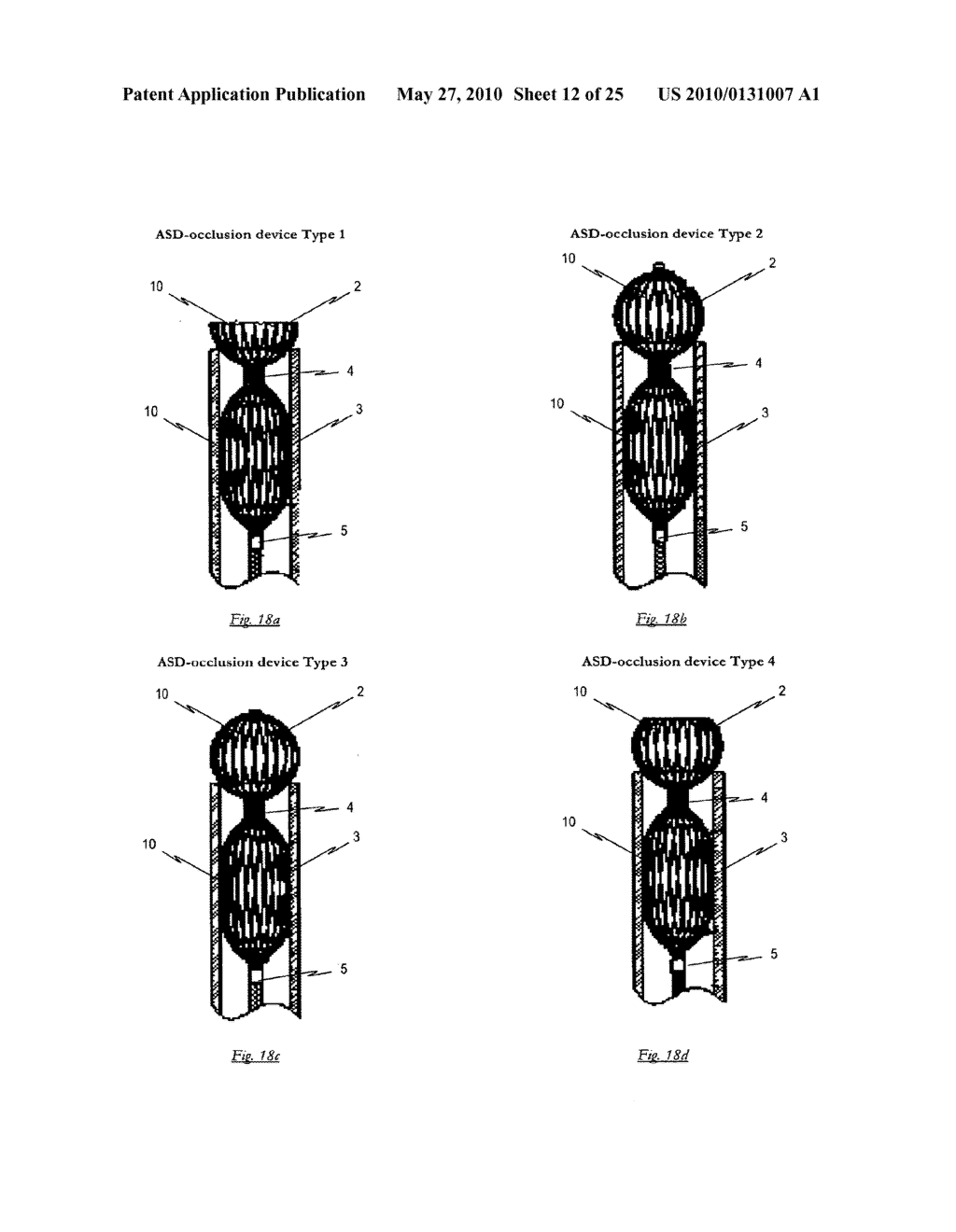 Self-Expanding Medical Occlusion Device - diagram, schematic, and image 13