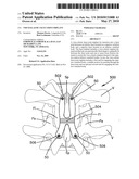 VISCO-ELASTIC FACET JOINT IMPLANT diagram and image