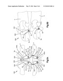 VISCO-ELASTIC FACET JOINT IMPLANT diagram and image