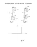 EXTRA DISCAL INTERVERTEBRAL STABILIZATION ELEMENT FOR ARTHRODESIS diagram and image