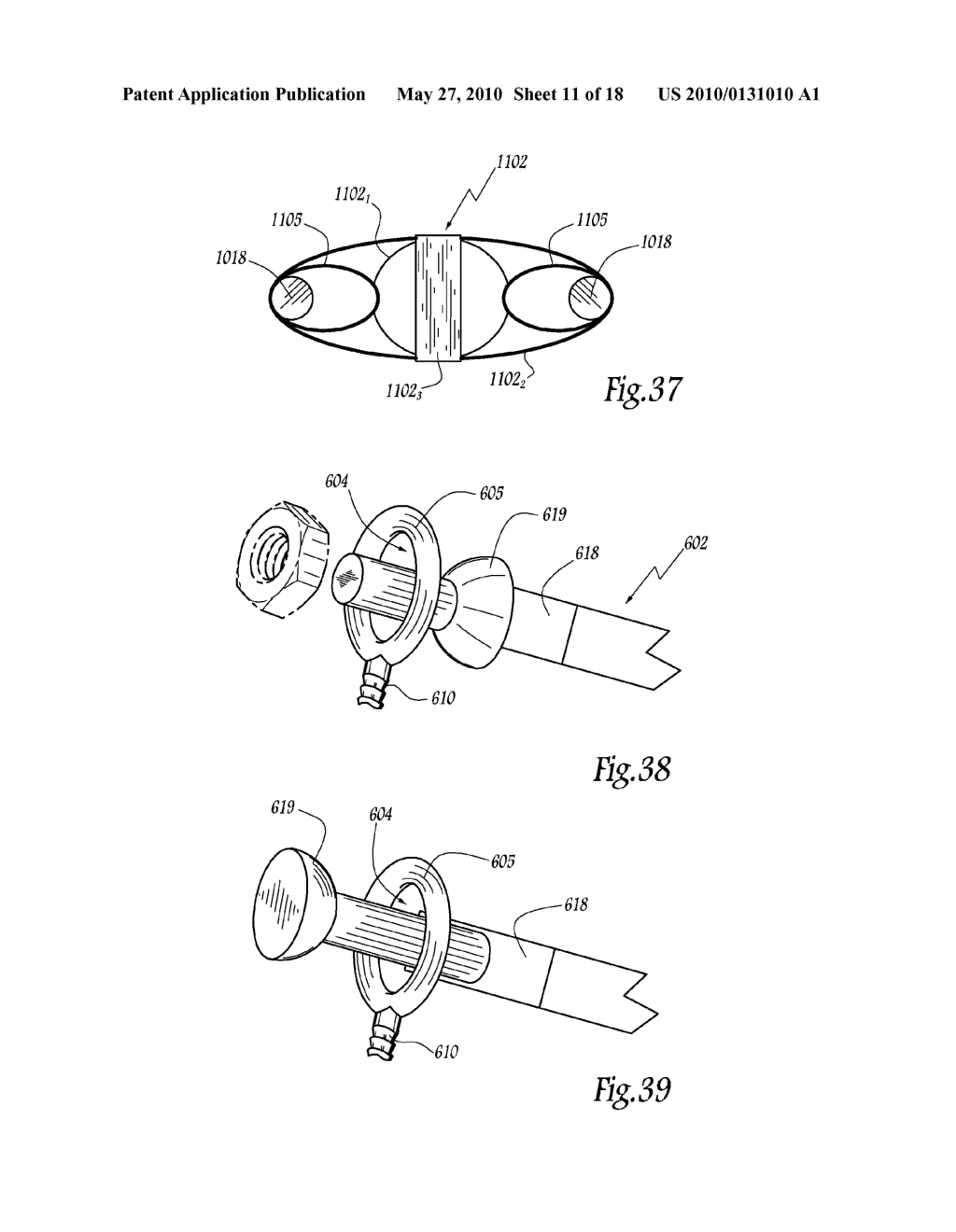 EXTRA DISCAL INTERVERTEBRAL STABILIZATION ELEMENT FOR ARTHRODESIS - diagram, schematic, and image 12