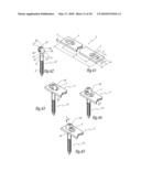 EXTRA DISCAL INTERVERTEBRAL STABILIZATION ELEMENT FOR ARTHRODESIS diagram and image