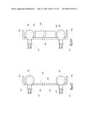 EXTRA DISCAL INTERVERTEBRAL STABILIZATION ELEMENT FOR ARTHRODESIS diagram and image