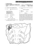 SACROILIAC JOINT IMMOBILIZATION diagram and image