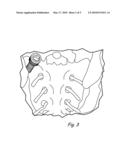 SACROILIAC JOINT IMMOBILIZATION diagram and image