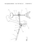 LOCATING A BONE AXIS diagram and image