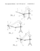 LOCATING A BONE AXIS diagram and image